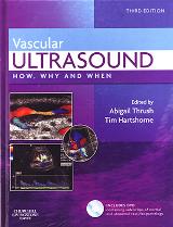 ProductID - 92 - VASC-ULTRASOUND--ABIGAILTHRUSH-TIMHARTSHORNE-LARGE