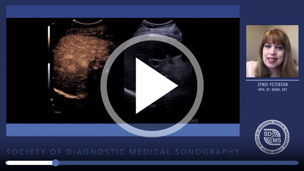 Video thumbnail with play button