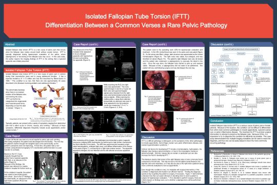 2020 Sonographer Poster 1st Place - Isolated Fallopian Tube Torsion 2020 Sonographer Poster 1st Place - Isolated Fallopian Tube Torsion